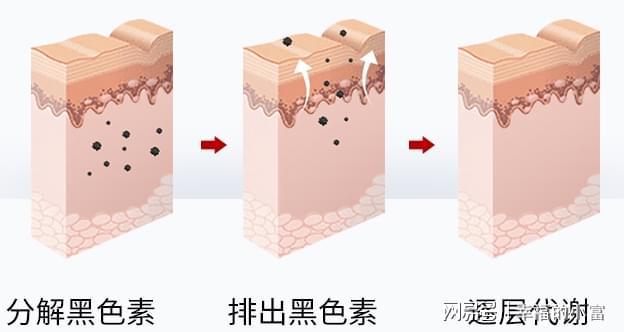 淡斑效果好的护肤品秋季盘的祛斑产品(图5)